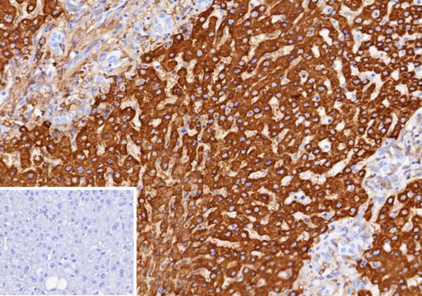 CPS1 Antibody in Immunohistochemistry (IHC (P))