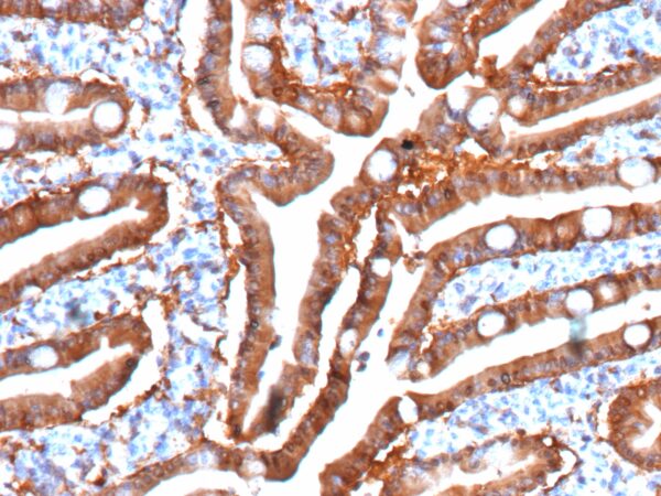 FABP2 Antibody in Immunohistochemistry (IHC (P))