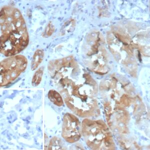 FABP2 Antibody in Immunohistochemistry (IHC (P))