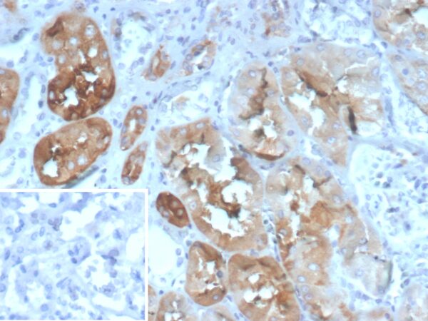 FABP2 Antibody in Immunohistochemistry (IHC (P))