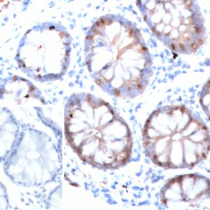 FABP2 Antibody in Immunohistochemistry (IHC (P))