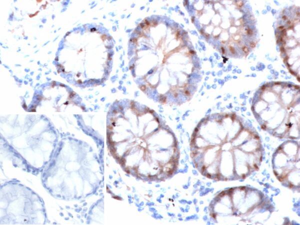 FABP2 Antibody in Immunohistochemistry (IHC (P))