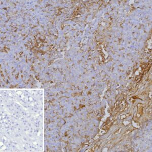 p170 / MDR1 Antibody in Immunohistochemistry (IHC (P))