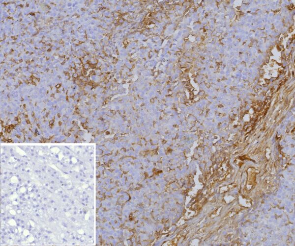 p170 / MDR1 Antibody in Immunohistochemistry (IHC (P))