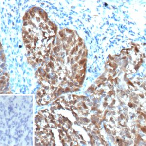 p16INK4a / CDKN2A Antibody in Immunohistochemistry (IHC (P))