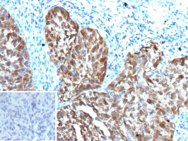 p16INK4a / CDKN2A Antibody in Immunohistochemistry (IHC (P))