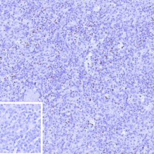 Perforin-1 Antibody in Immunohistochemistry (IHC (P))