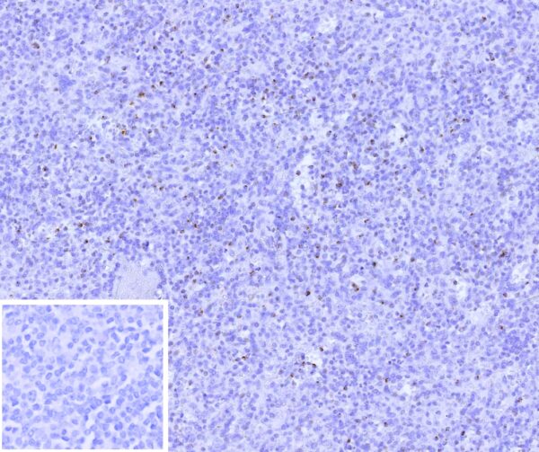 Perforin-1 Antibody in Immunohistochemistry (IHC (P))