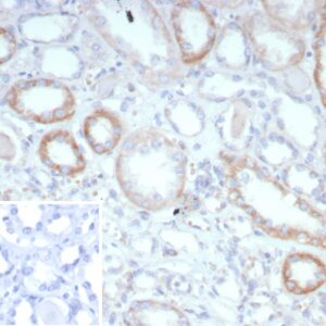 TEK / TIE2 Antibody in Immunohistochemistry (IHC (P))