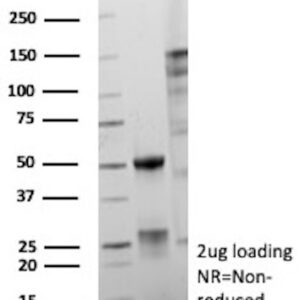 ERG Antibody in SDS-PAGE