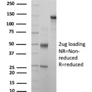 Folate Receptor Alpha Antibody in SDS-PAGE