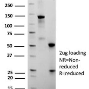 Folate Receptor Alpha Antibody in SDS-PAGE