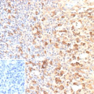 IL2RA / CD25 Antibody in Immunohistochemistry (IHC (P))