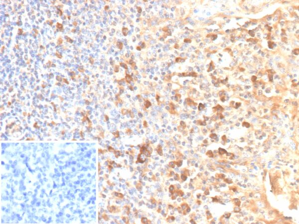 IL2RA / CD25 Antibody in Immunohistochemistry (IHC (P))