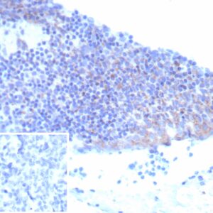 IL2RA / CD25 Antibody in Immunohistochemistry (IHC (P))