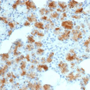 Folate Receptor Alpha Antibody in Immunohistochemistry (IHC (P))