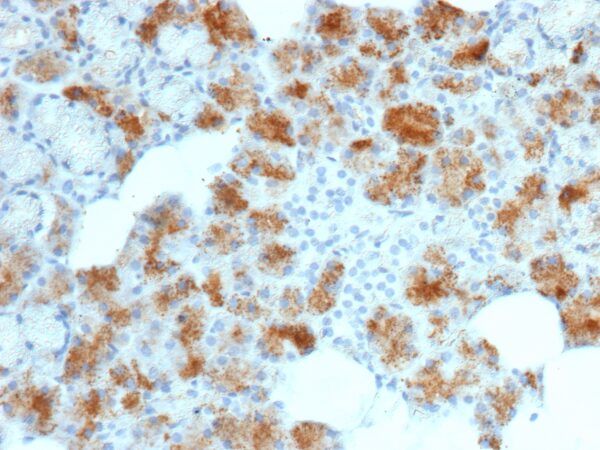 Folate Receptor Alpha Antibody in Immunohistochemistry (IHC (P))